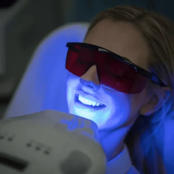 How Does Laser Whitening Adapt for Clients with Retainers Coventry