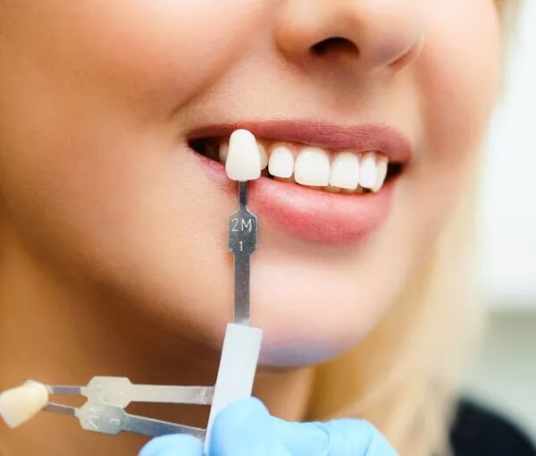 Are There Any Special Precautions for Jaw-Grinders Getting Laser Whitening Coventry