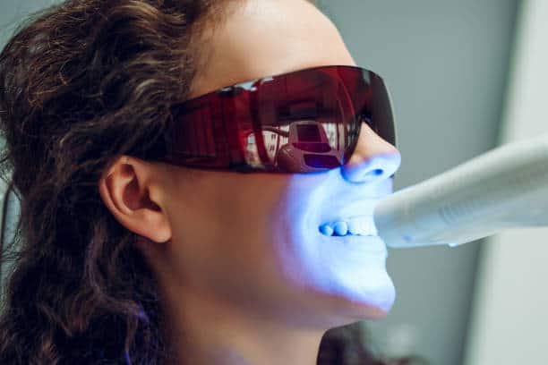 Can the Laser Teeth Whitening Process Be Adjusted for Uneven Tooth Colour Coventry