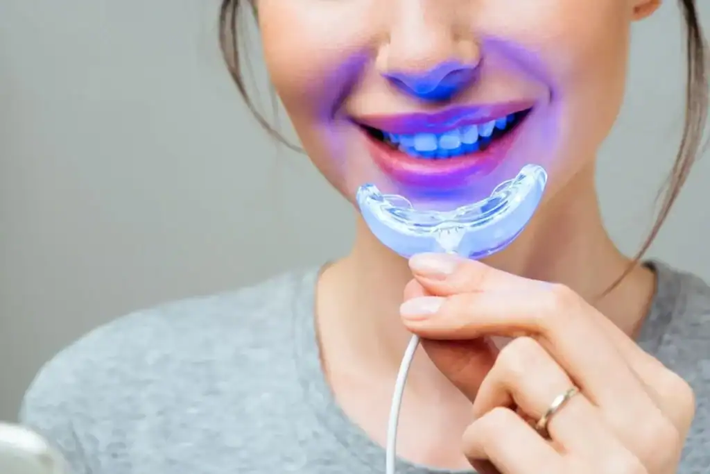 Woman using at-home BBlue Light Teeth Whitening Leamington Spa device for a brighter smile Coventry