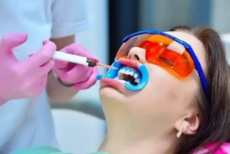 Can Laser Teeth Whitening Worsen Jaw Tension or Tooth Sensitivity from Grinding Coventry
